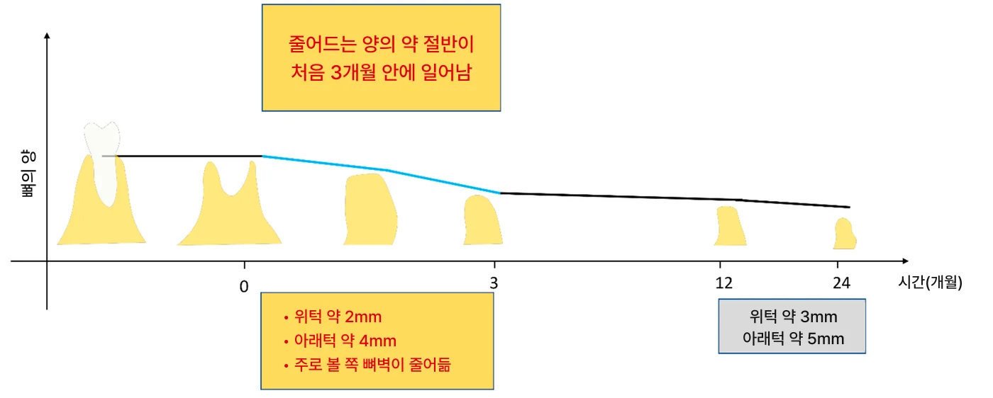 치아, 뽑기 전에 확인해야 할 여섯 가지