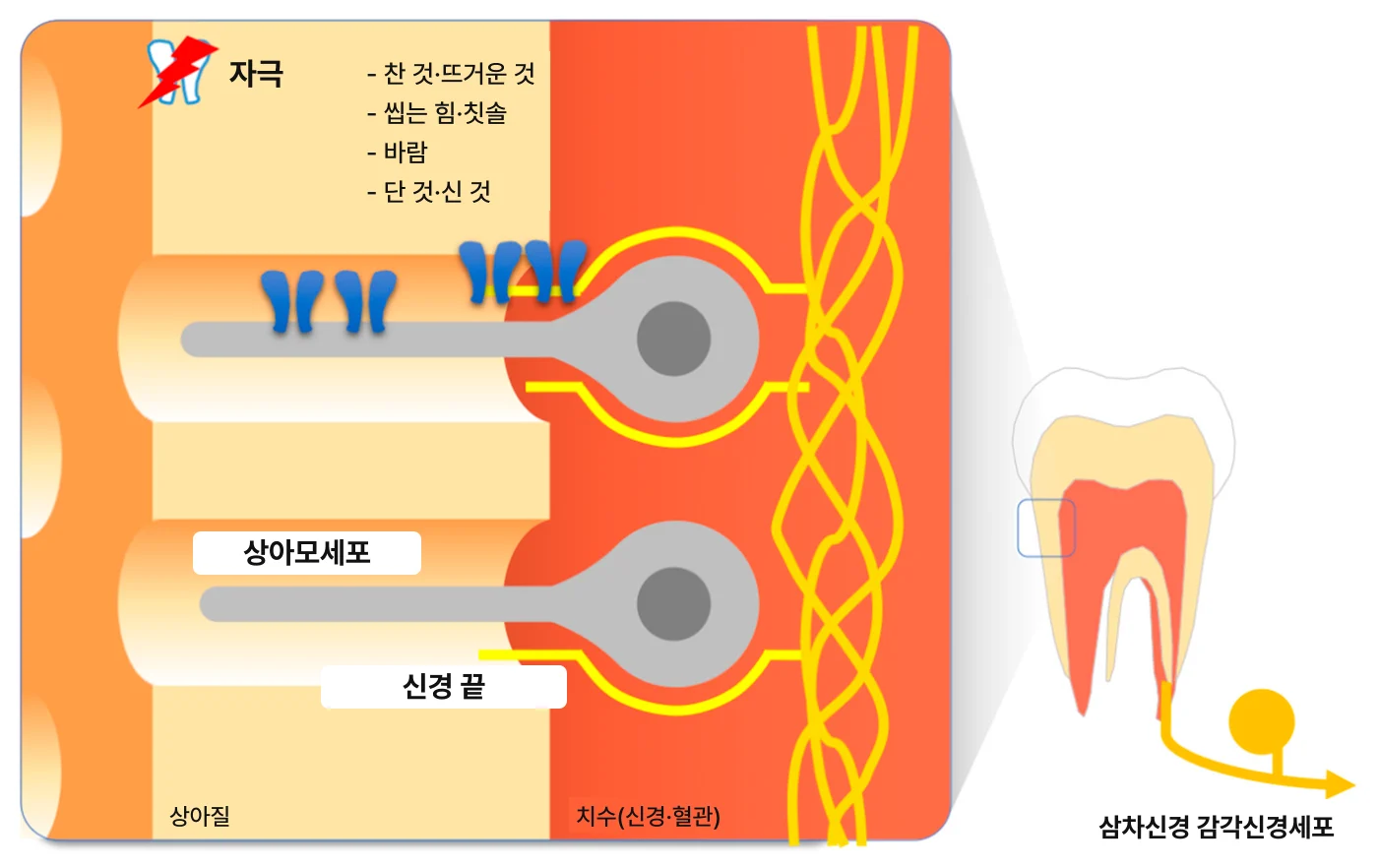 충치 치료 후 시린 것, 어디까지 정상 범위일까